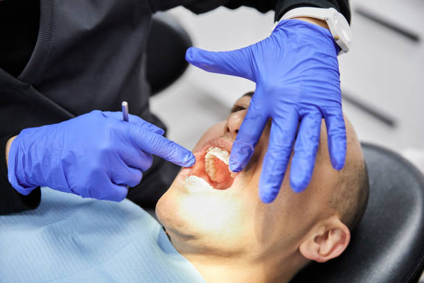 Best Emergency Dental Care for Sports Injuries in San Juan Bautista, CA